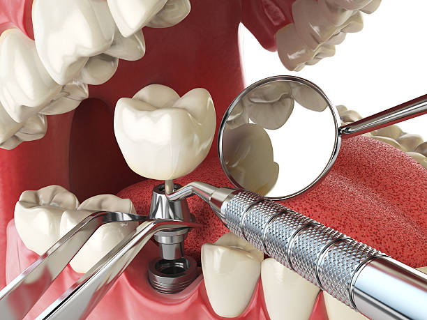 Best Knocked-Out Tooth Emergency  in Nanticoke, PA